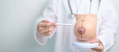 Augmentation mammaire en Tunisie : prix et déroulement de l'intervention