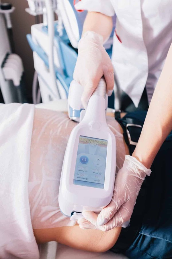 Cryolipolyse à nice : votre diagnostic offert